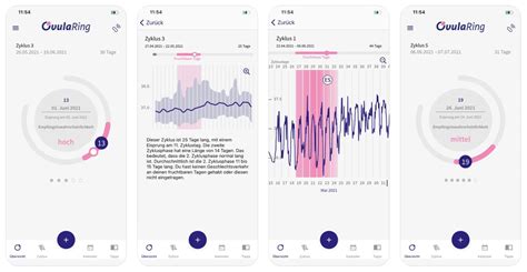 Abbildung eines OvulaRings und der dazugehörigen App-Oberfläche