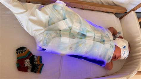 Grafik zur Darstellung des Bilirubinspiegels und der Indikationen zur Phototherapie bei Neugeborenen