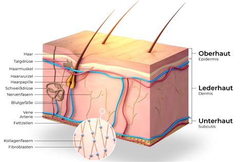 Schema der Hautschichten und der Lokalisation von Blasenbildung bei verschiedenen EB-Typen