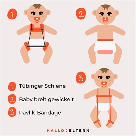 Schema einer Spreizhose mit unterschiedlichen Einstellungsmöglichkeiten