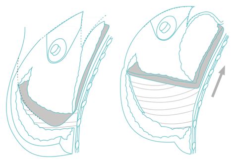Illustration der 