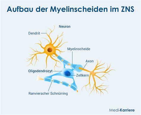 Schema der Nervenfaser mit Myelinscheide und Angriffe durch das Immunsystem bei Multipler Sklerose