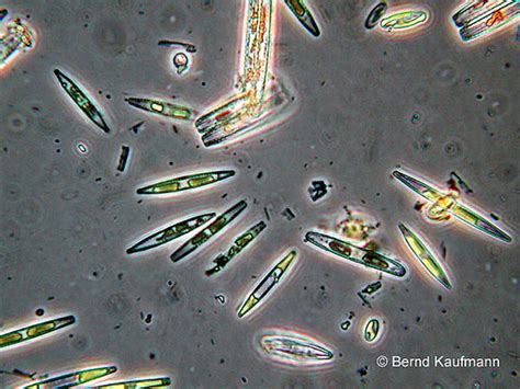 Mikroskopische Aufnahme von Kieselalgen (Diatomeen), den Hauptbestandteilen von Kieselgur.