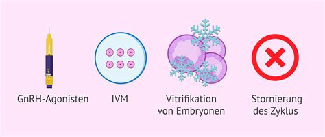 Schema zur Veranschaulichung des Ovariellen Hyperstimulationssyndroms (OHSS) und seiner Behandlungsschritte.