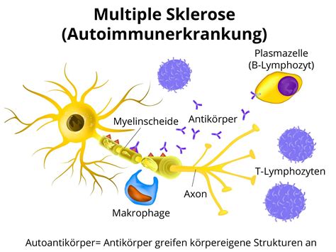 Schema der Wirkungsweise von Ocrelizumab auf B-Zellen bei Multipler Sklerose.