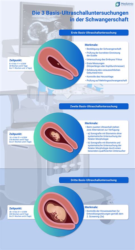 Infografik, die das Schubrisiko bei MS vor, während und nach der Schwangerschaft darstellt.
