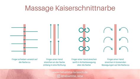 Beispiel für eine Kaiserschnittnarbe, die durch regelmäßige Massage und Pflege verbessert wird.