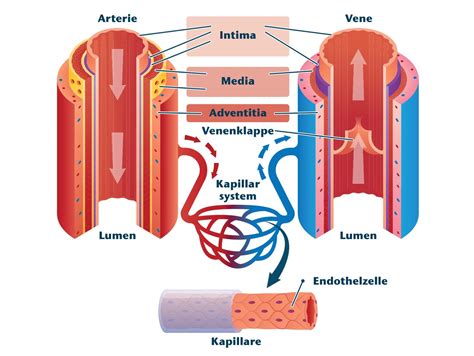 Schema der Anatomie einer Dornwarze mit Hervorhebung der inneren Struktur und der Blutgefäße
