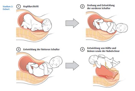 Schema, das die Position des Babys im Becken vor und während der Geburt zeigt, mit und ohne vorherige Senkung des Bauches.