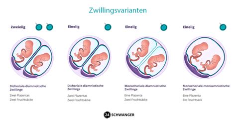 Schema, das die verschiedenen Arten von Zwillingsschwangerschaften (mono-mono, mono-di, di-di) und ihre jeweiligen Plazenta- und Fruchtblasenstrukturen zeigt.