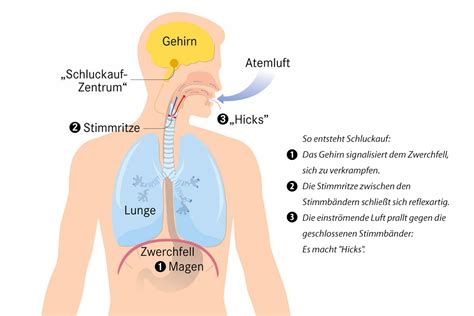 Schema des Zwerchfells und der Atemwege, das die Entstehung von Schluckauf illustriert.