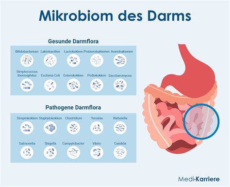 Infografik, die die Unterschiede im Darm-Mikrobiom zwischen vaginal geborenen und per Kaiserschnitt geborenen Kindern darstellt.