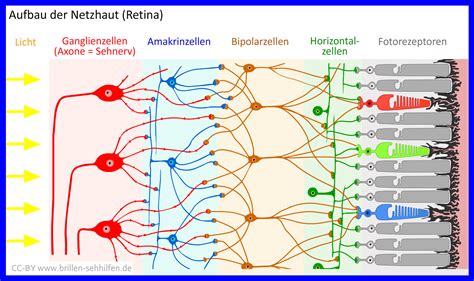 Beispiel einer Fluoreszenz-Angiographie, die durchblutete und nicht-durchblutete Bereiche der Netzhaut zeigt