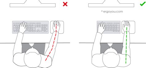 Illustration, die die korrekte Positionierung der Sicherungsstifte und Armstützen am Kinderwagengriff zeigt.