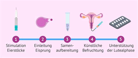 Grafik, die den Ablauf einer Insemination darstellt