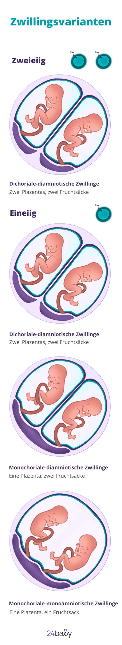 Symbolbild für Zwillinge, das die doppelte Herausforderung, aber auch die Freude einer Zwillingsschwangerschaft darstellt