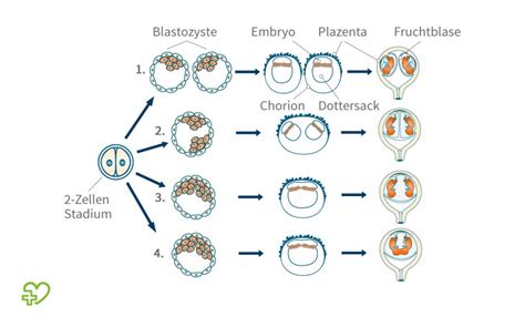 grafische Darstellung der Entstehung von eineiigen und zweieiigen Zwillingen