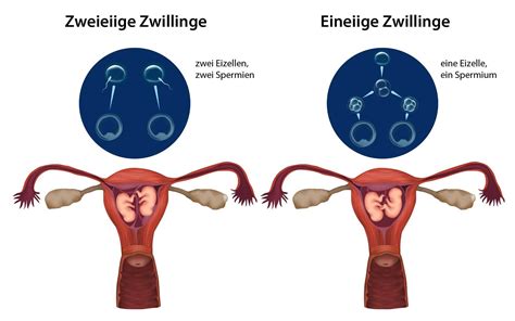 Vergleich von eineiigen und zweieiigen Zwillingen: Gemeinsamkeiten und Unterschiede