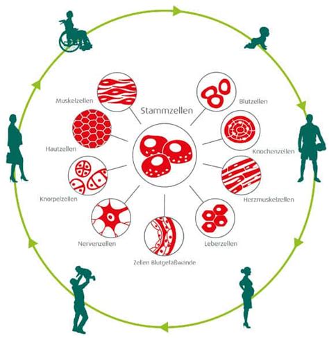 Infografik: Wann kommen Stammzellen aus Nabelschnurblut zum Einsatz?