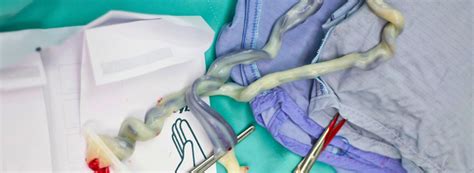 Nahaufnahme der Nabelschnur mit den Blutgefäßen, die durch die Eihäute verlaufen