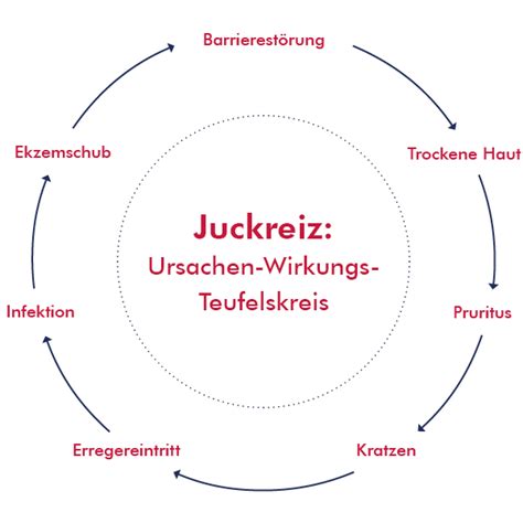 Infografik, die verschiedene Ursachen für Juckreiz nach der Geburt und die entsprechenden Handlungsaufforderungen (z.B. Arzt aufsuchen, Hausmittel anwenden) darstellt.