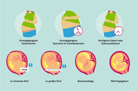 Grafik: Risiken eines Kaiserschnitts im Vergleich zur natürlichen Geburt