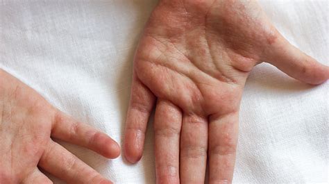 Detailaufnahme von warmen Händen, die sanft ein Babyöl in den Handflächen verreiben.