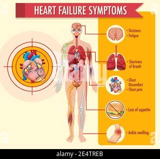 Infografik zu den Symptomen einer Salmonelleninfektion