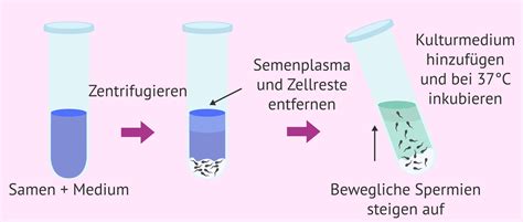 Laborgerät zur Spermienaufbereitung