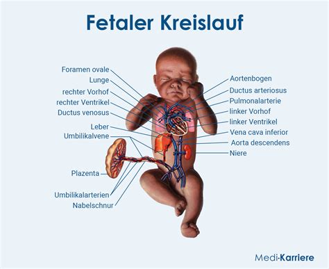 Grafik, die verschiedene Geburtsrisiken bei fetaler Makrosomie veranschaulicht, wie Schulterdystokie und Geburtsverletzungen.
