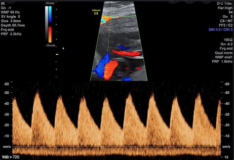 Infografik: Was ist bei der Feindiagnostik erkennbar und was nicht?