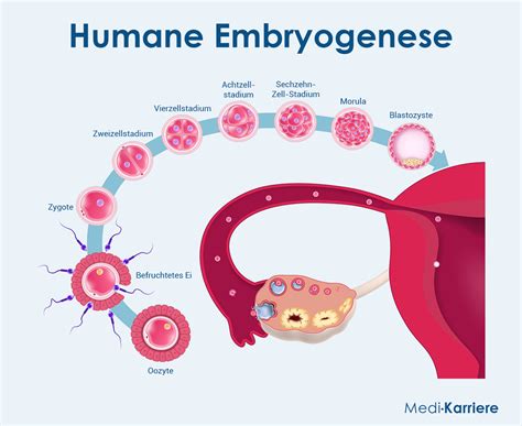 Schema des Embryotransfers und der Einnistung