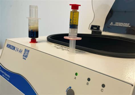 Schema der Behandlung des Achermann-Syndroms mit Eigenblutplasma