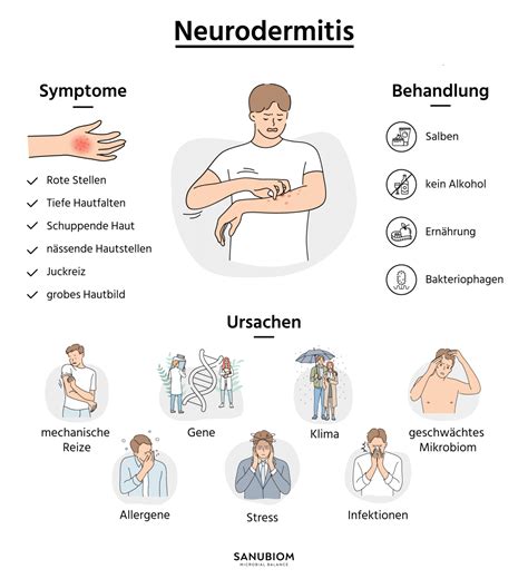 Schema der Symptome und Lokalisation von Neurodermitis bei Säuglingen und Schulkindern