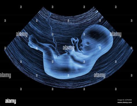 Ultraschallbild eines Babys im Mutterleib.