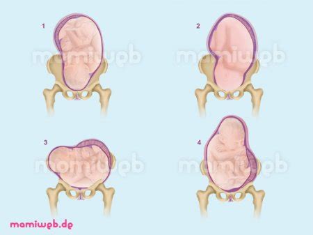Grafik zur Überprüfung der Kopfposition des Babys im Kindersitz