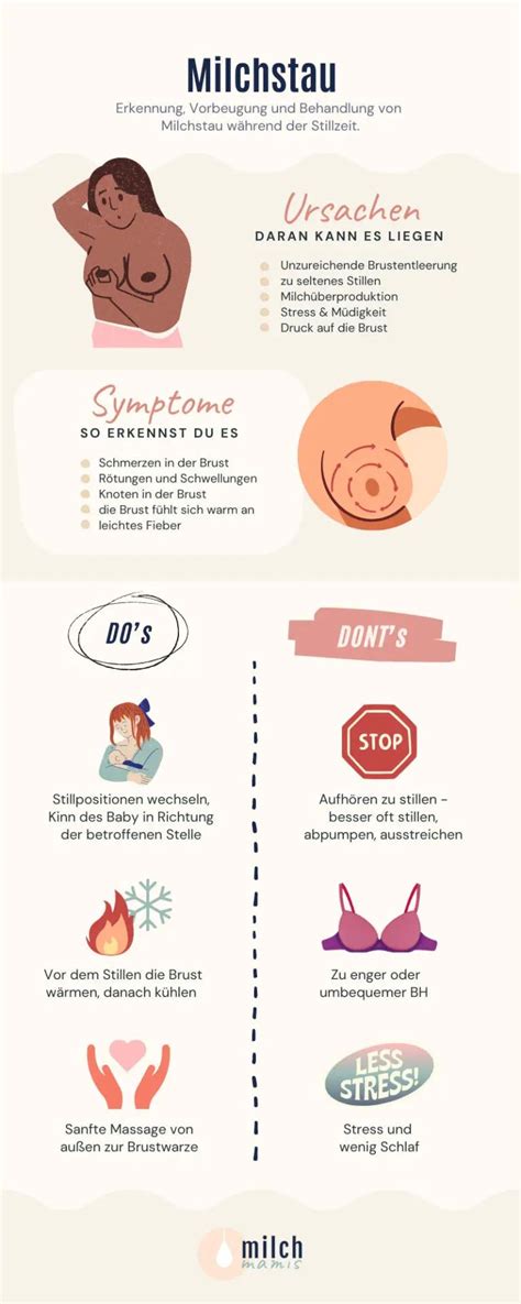 Illustration einer stillenden Mutter mit Anzeichen eines Milchstaus