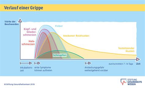 Grafik, die den typischen Verlauf eines Fieberkrampfes bei Kindern zeigt