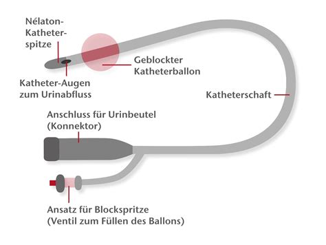 Schema zur Durchführung des Pregnafix Schwangerschaftstests mit Urin