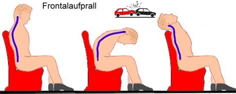 Schema zur Funktionsweise eines Reboarders im Vergleich zu einem vorwärtsgerichteten Sitz bei einem Frontalaufprall