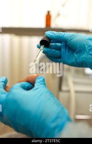 Nahaufnahme einer Pipette, die Muttermilch in ein Baby-Nasenloch tropft.