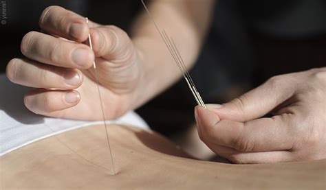 Porträt einer Heilpraktikerin, die eine Akupunkturnadel hält.