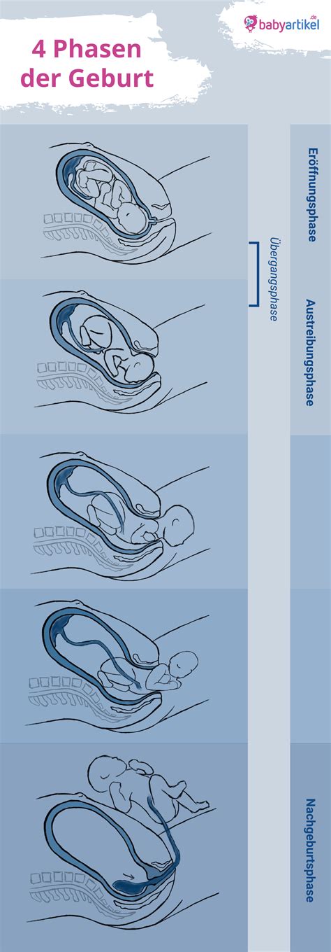 Infografik: Phasen der Geburt und die Rolle der Begleitperson