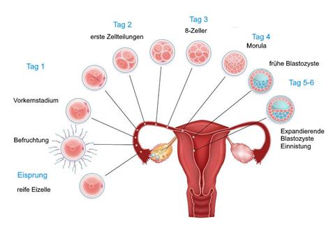 Schema zur Unterstützung der Einnistung nach dem Embryotransfer