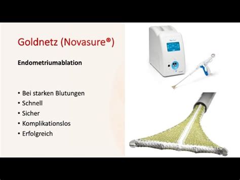 Schema der Goldnetz-Methode (NovaSure)