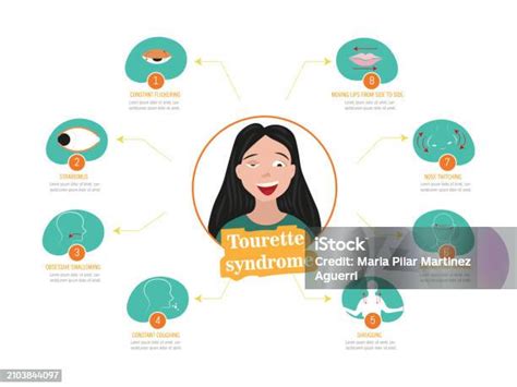 Infografik mit den häufigsten Symptomen des Down-Syndroms.