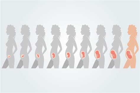 Schema, das die möglichen Outcomes einer Schwangerschaft mit unklarem Sitz (PUL) darstellt, einschließlich ektoper Schwangerschaft und normaler intrauteriner Schwangerschaft.