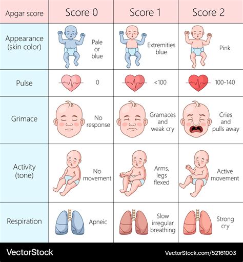 Illustration eines Neugeborenen mit schlechten Apgar-Werten