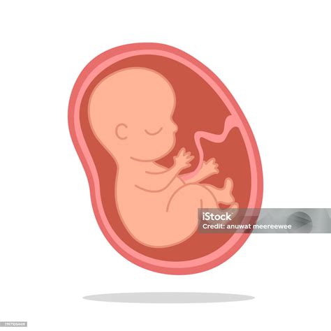 Illustration der Querlage eines Fötus im Mutterleib