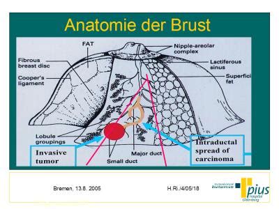 Illustration der Brustdrüse mit Fokus auf die Milchgänge.
